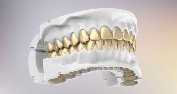 3d dentale mascelle replica staccabile denti biologia protesi dente mascella bocca anatomia odontoiatria orale stomatologia ammaccatura umano medico dentista scienza gomma osso 3dprinting 3d print model - Mito3D