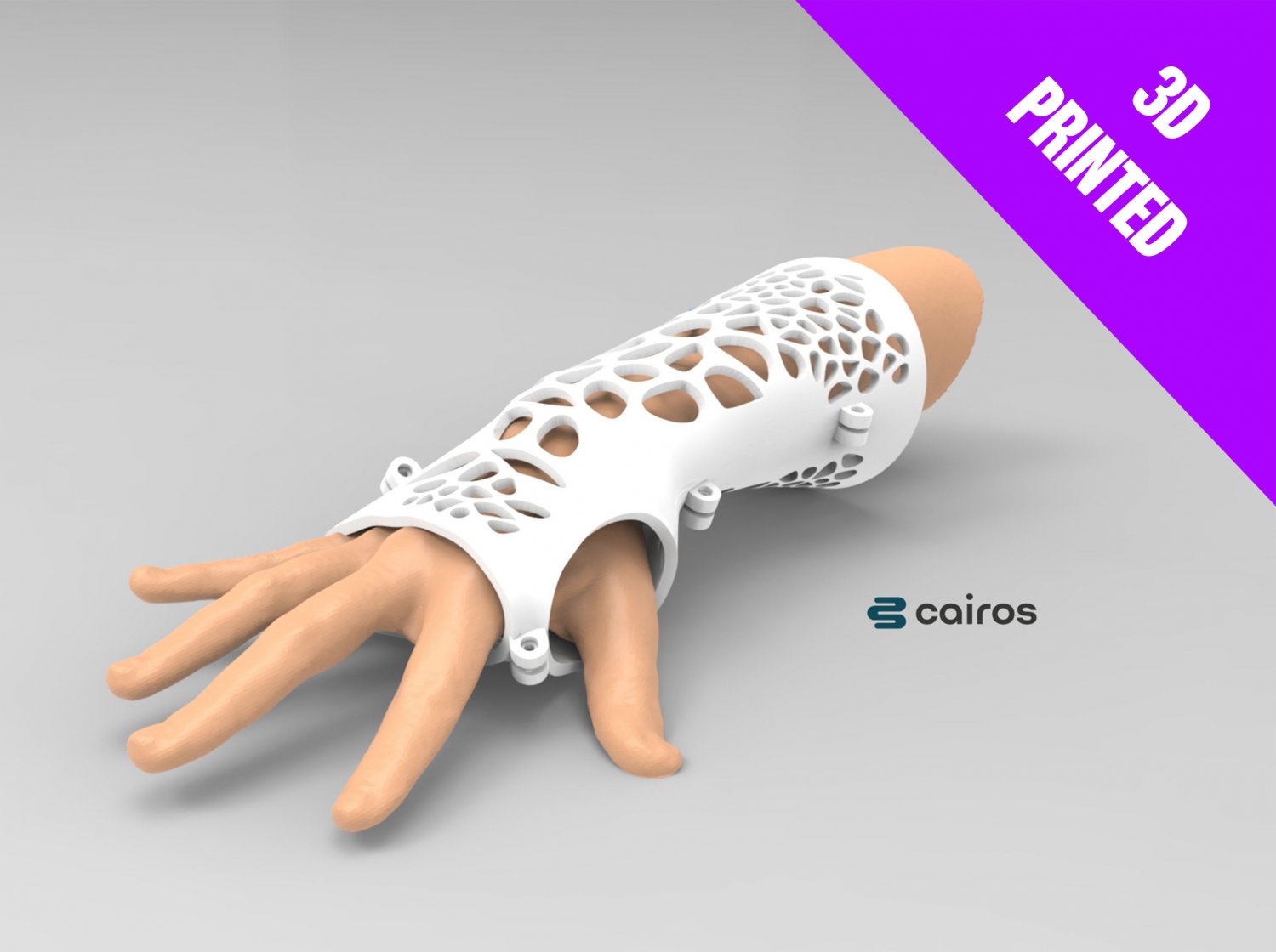 kol atel 3d yazdır model in mühendislik 3dexport 3dprinted basılı 3dprint anatomi bilim alçı oyuncular ferula voronoi tasarım tıbbi 3D print model - Mito3D