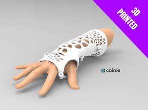 brazo entablillar 3d impresión modelo in ingenieria 3dexport 3dprinted impreso 3dprint anatomía ciencias yeso emitir ferula voronoi diseño médico 3d print model - Mito3D