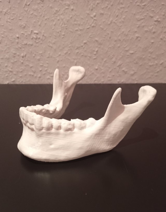 umano mascella anatomico 3d stampa modello in astronomia fisica 3dexport corpo anatomia denti dentista 3D print model - Mito3D