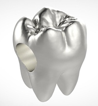 pandora dente charme 3d impressão modelo in pingentes 3dexport dentes fundição moagem derretendo prata moda jóias colar anel pulseira gemas joias brinco 3d print model - Mito3D