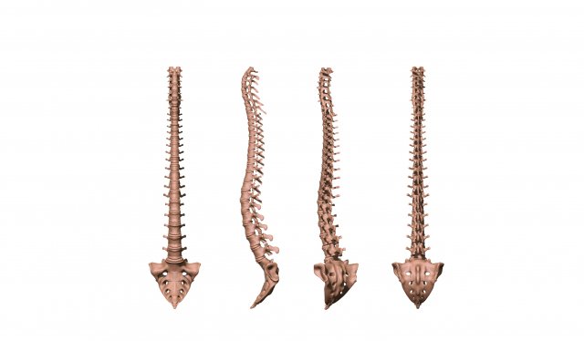 spine printable 3d print model in 3dexport anatomy back backache backbone bones cervical column human neurosurgery scoliosis spinal vertebra vertebral science 3D print model - Mito3D