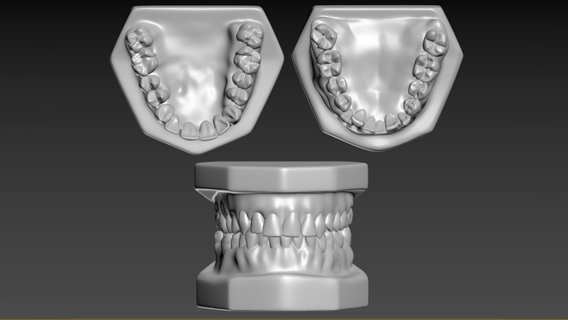 teeth biology tooth medical medicine dentistry dental dentist 3d print model - Mito3D