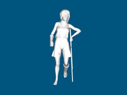 girl crutches 3d print model - Mito3D