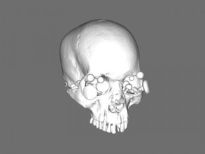 hongo cráneo libre modelo 3d - descargar archivo stl Art Escultura viejo cubierto de 3d print model - Mito3D