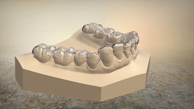 3d digital b férulas dental canalla ortodoncia stl ciencias odontología dentista medicamento escáneres 3shape diente 3d print model - Mito3D