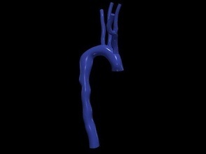 3d model aorta anatomy body science medicine organ aortic arch ascending cardiovascular biology 3d print model - Mito3D
