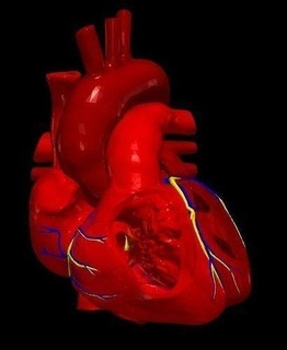 3d modelo corazón auricular septal defecto anatomía biología médico medicamento Ciencias humano cardiovascular cardíaco 3d print model - Mito3D