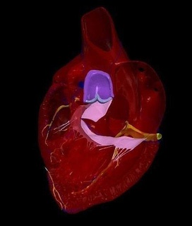3d modèle cœur auriculo ventriculaire septale défaut 4 chambre médicament médical sympathique cardiovasculaire atrium medicine3d 3dmedical science biologie 3d print model - Mito3D