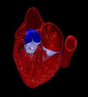 3d model heart tetralogy fallot long axis cardiovascular tof medical medicine cardiac education anatomy human 3danatomy 3dheart science biology 3d print model - Mito3D