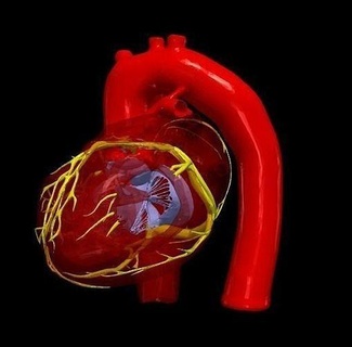 3d model heart tetralogy fallot medicine medical cardiovascular cardiac tof congential science education modelling 3dprint 3dmodel biology 3d print model - Mito3D