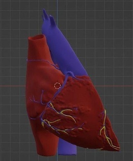 3d modèle cœur transposition génial artères cardiovasculaire artère cardiaque sympathique santé médicament médical éducation science biologie 3d print model - Mito3D