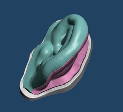 3d impressão mofo orelha silicone prótese anaplastologia maxilofacial anatomia arte esculturas 3d print model - Mito3D