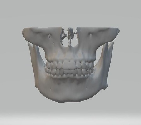 3d imprimable crâne 3dprinting 3dskull médical fichier stéréolithographie stl conception os zygomatique zygoma maxillaire éducation thèse pharmaceutique science biologie 3d print model - Mito3D