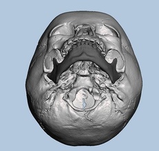 3d skull model converted dicom data human head anatomy science bone skeleton teeth ctscan biology 3d print model - Mito3D