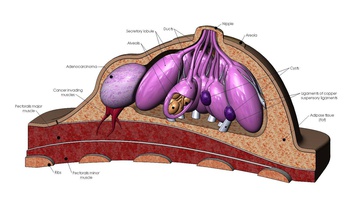 meme anatomi 3d model hastalıklar kist kanser bağ şişman doku lobüller kaslar pirzola eğitici biyoloji anatomik kadın tıbbi organ bilim sağlık 3d print model - Mito3D