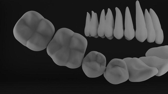 anatomy teeth roots dental cavity composite class 2 arch upper lower tooth quadrant science biology dentist dentistry incisor orthodontist 3d print model - Mito3D
