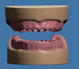 base gum data dental anatomical typodont teeth tooth dentistry mouth smile bone enamel dentin molar science biology 3d print model - Mito3D