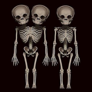 child skeleton stl anatomia anatomy esqueleto infantil cuerpo medicina death dead horror art sculptures 3d print model - Mito3D