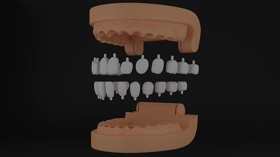 zusammenklappbar 3d Modell Zähne Anatomie Dental Hohlraum zusammengesetzt Klasse 2 Bogen Oberer höher niedriger Zahn Quadrant Wissenschaft Biologie Zahnarzt Zahnheilkunde Schneidezahn Kieferorthopäde 3d print model - Mito3D