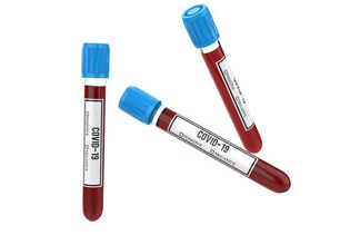 covid-19 tubo de ensaio covid 19 proteção recursos sangue o teste corona vírus coronavírus madical laboratório covid19 sarscov2 vidro equipamento líquido análise plástico ciência biologia 3d print model - Mito3D
