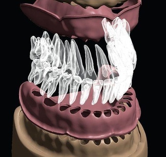 d007 diş anatomi model doğal kök kanal hekimliği emaye doktoru azı dişi dişlenme teknolojisi Bilim Biyoloji 3d print model - Mito3D