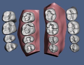 d004 dentale anatomia modello intarsio composito pratica odontoiatria tecnologia bocca scienza biologia 3d print model - Mito3D