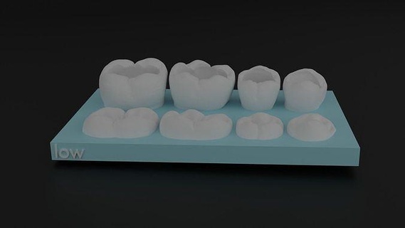 dentaire cambre modèles 3d impression modèle anatomie cavité composite classe 2 dents dent quadrant science biologie dentiste dentisterie incisive orthodontiste 3d print model - Mito3D