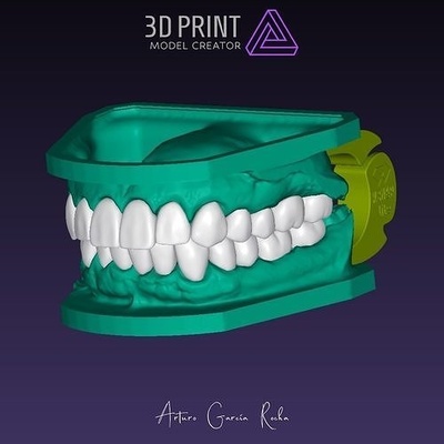 dental model crowns implants invisalign tooth veneers hygienist oral surgeon crown extraction teeth cavity braces exocad cad cam digital science biology 3d print model - Mito3D