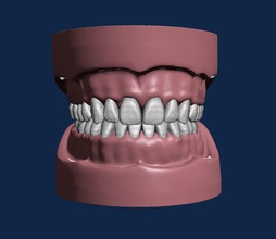 d003 dental modell anatomie typodonten prothese oral zahn zähne zahnheilkunde kiefer mund zahnarzt zahntechnik wissenschaft biologie 3d print model - Mito3D