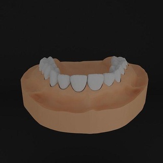 dentale Modelli naturale denti 3d modello collezione anatomia cavità composito classe 2 arco superiore inferiore dente quadrante scienza biologia dentista odontoiatria incisivo ortodontista 3d print model - Mito3D