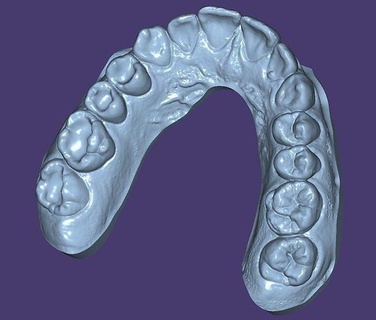 dental práctica compuesto 3d modelo real dientes diente cavidad Ciencias biología entrenamiento 3d print model - Mito3D