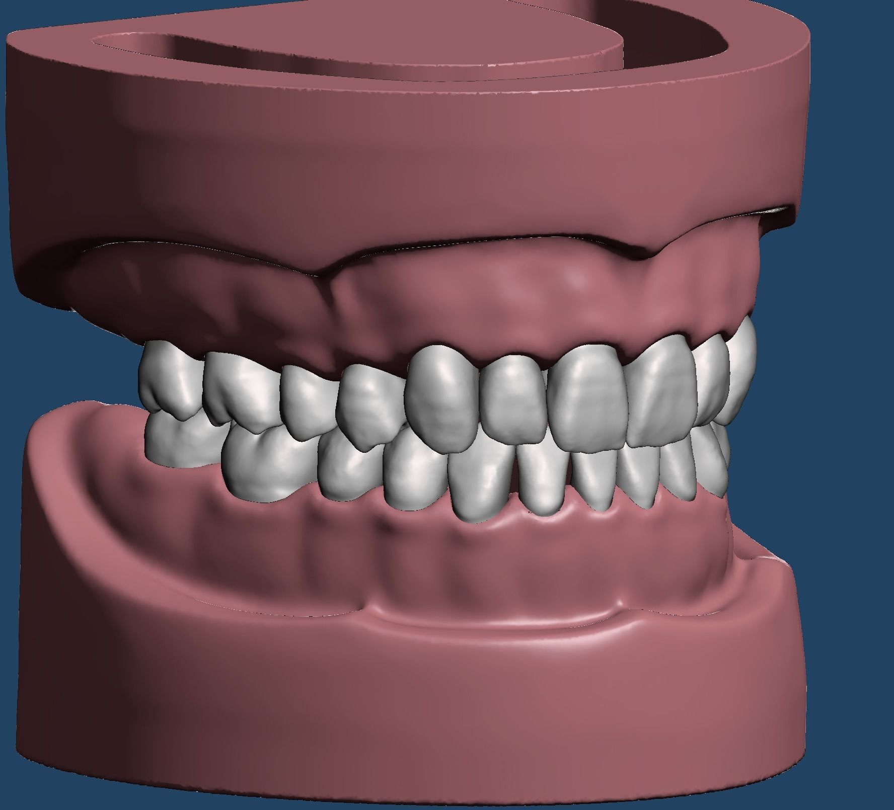 dental sample model dentist dentistry dentaltechnology dentaltechnician oral anatomy teeth mouth typodont art sculptures 3D print model - Mito3D