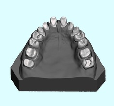 dental sample model maxillary teeth anatomy tooth dentistry dentaltechnology mouth dentalsample science biology 3d print model - Mito3D