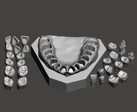 d001 dentaire échantillon modèle dentiste technicien anatomie dents typodonte laboratoire science biologie 3d print model - Mito3D