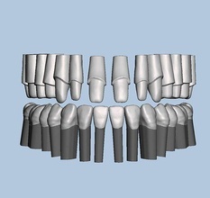 dentale tipodonte corone denti dente dentista odontoiatria tecnologia bocca campione corona radice scienza biologia 3d print model - Mito3D