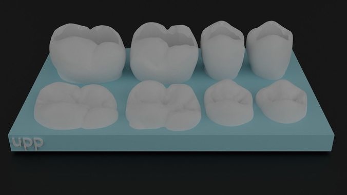 diş üst kemer modeller 3d Yazdır model anatomi boşluk bileşik sınıf 2 çeyrek daire Bilim Biyoloji doktoru hekimliği kesici ortodontist vücut karakter 3D print model - Mito3D