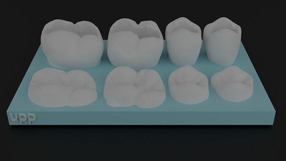 Dental Oberer höher Bogen Modelle 3d drucken Modell Anatomie Hohlraum zusammengesetzt Klasse 2 Zähne Zahn Quadrant Wissenschaft Biologie Zahnarzt Zahnheilkunde Schneidezahn Kieferorthopäde Körper Charakter 3d print model - Mito3D