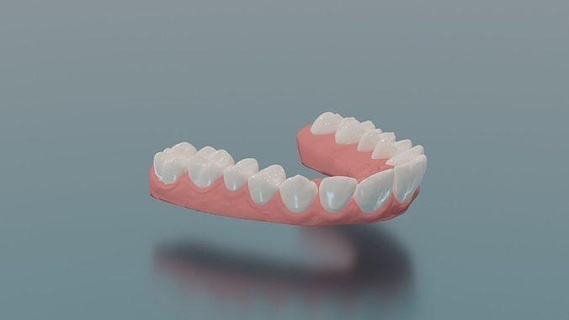 dental upper jaw 3d scanned mouth separated teeth tooth dentist medical medicine molar jawbone realistic science dentistry 3dprint medicalprint case dentalprosthesis printe astronomy physics 3d print model - Mito3D