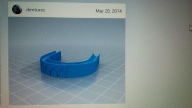 zahnersatz prothese mund zähne turnhallen essen dental zahnheilkunde wissenschaft 3d print model - Mito3D