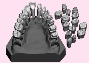 die set dental sample model maxillar teeth anatomy tooth jaw dentistry dentaltechnology crown inlay veneer science biology 3d print model - Mito3D