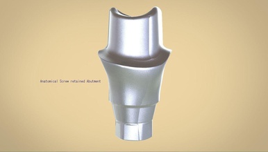 digital cemented retained abutment dental implant anatomical positioning guide 3shape keyshot pro dentist teeth jaw science 3d print model - Mito3D