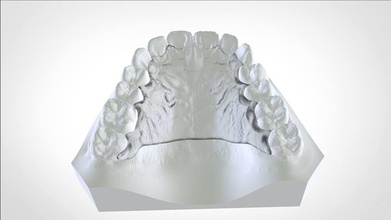 digital cranham deprogrammer science dental splint 3d orthodontics medical 3shape rami pdf 3dpdf keyshot lab tech 3dscan scanner design tooth cad other 3d print model - Mito3D