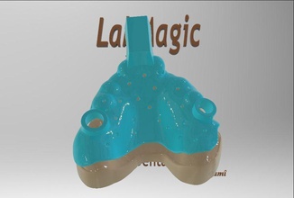 digitale dentale personalizzato impressione vassoio cadcam 3shape labmagic3dcad protesi denti scienza dentista medicinale medico 3d print model - Mito3D