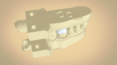 digital dental quadrant model a contour crown teeth dental3d 3dprint cnc cad 3shape printable keyshot render medical scanned 3dscanned stl obj science 3d print model - Mito3D