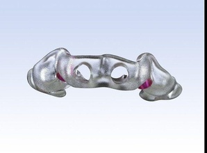 dijital sondaj kılavuz kollu diş cad 3shape doktoru bilim hekimliği ağız tıbbi ekipman protezler aşılama 3d cnc lazer sinterleme anahtar görüntü rhino3d implantolog 3d print model - Mito3D