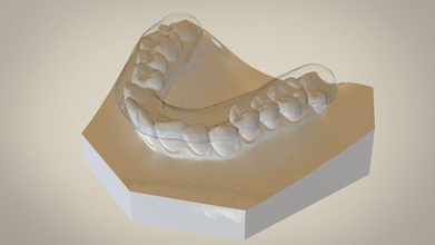 digital flat plane splint orthodontics science dental cad rhino other 3d print model - Mito3D