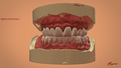digital dentadura postiza 3d impresión molienda 3shape canalla disparo llave laboratoriomagic diente médico dental ciencias desdentado medicamento cnc anatomía 3d print model - Mito3D