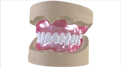 digital dentures combined glue-in teeth arch 3d cad 3dprint milling cnc artificial dental 3shape keyshot injection hd smile complete resin medical science 3d print model - Mito3D