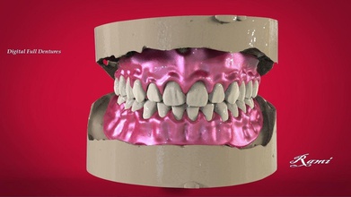 digitale protesi produzione opzioni dente 3d fresatura camera cad medico 3dprinting 3shape keyshot scienza odontoiatria medicinale 3d print model - Mito3D